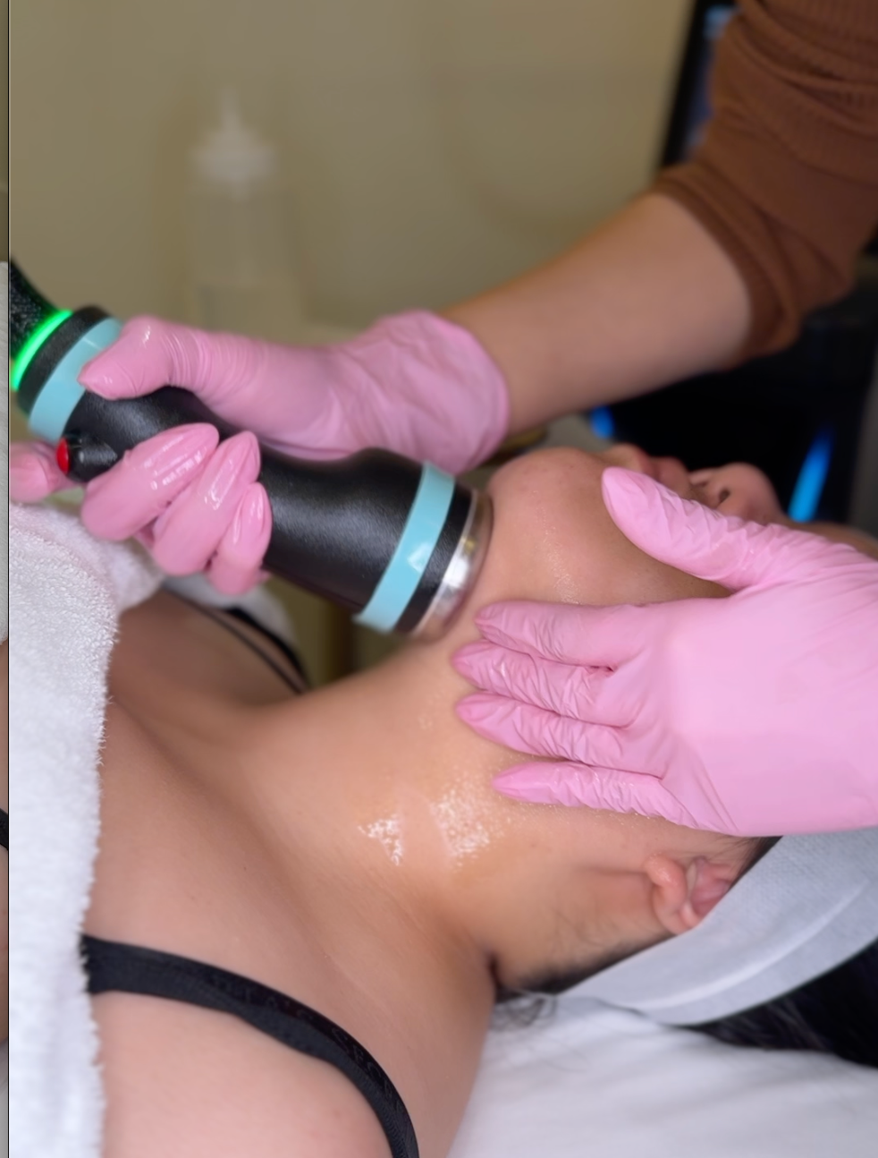 How Onda PRO® Face Sculpt Defines the Beverly Hills Jawline